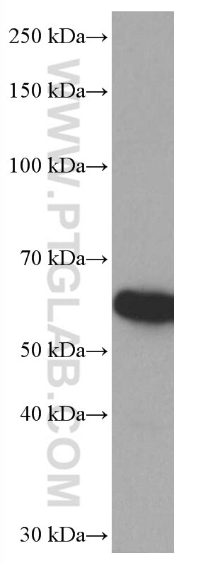 Western Blot (WB) analysis of HeLa cells using SPTLC1 Monoclonal antibody (66899-1-Ig)