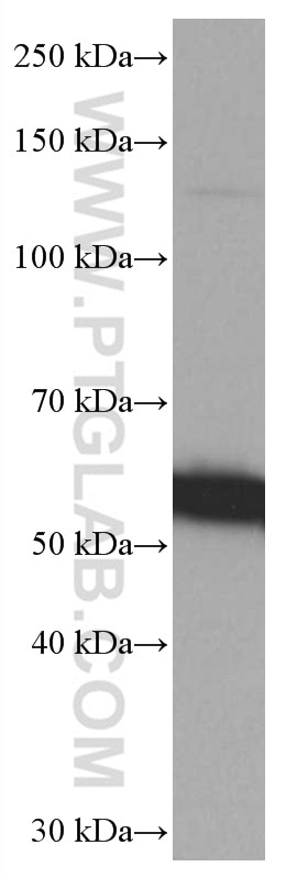 Western Blot (WB) analysis of Jurkat cells using SPTLC1 Monoclonal antibody (66899-1-Ig)