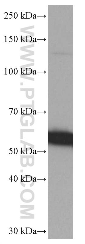 Western Blot (WB) analysis of Jurkat cells using SPTLC1 Monoclonal antibody (66899-1-Ig)