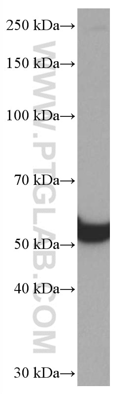 Western Blot (WB) analysis of HSC-T6 cells using SPTLC1 Monoclonal antibody (66899-1-Ig)