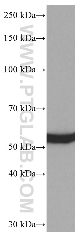Western Blot (WB) analysis of NIH/3T3 cells using SPTLC1 Monoclonal antibody (66899-1-Ig)