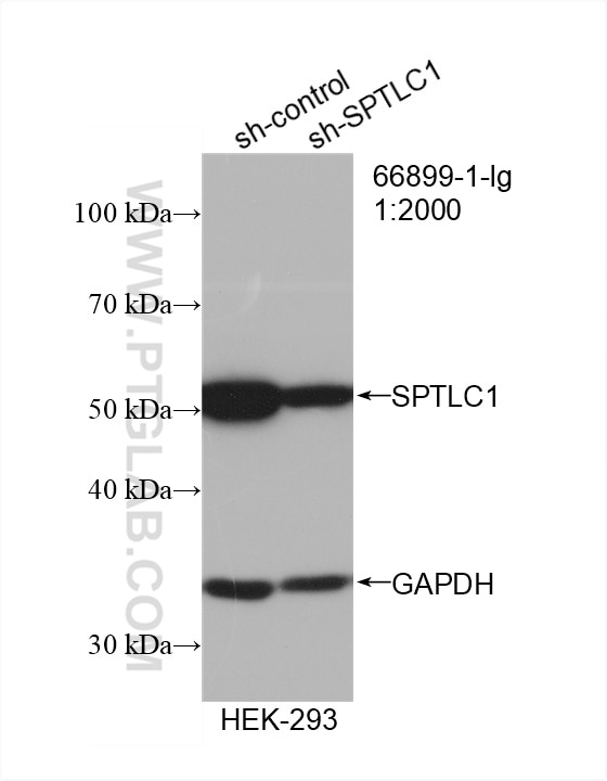 Western Blot (WB) analysis of HEK-293 cells using SPTLC1 Monoclonal antibody (66899-1-Ig)