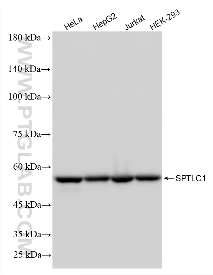 Western Blot (WB) analysis of various lysates using SPTLC1 Recombinant monoclonal antibody (87141-1-RR)