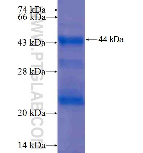SPTLC1 fusion protein Ag1162 SDS-PAGE
