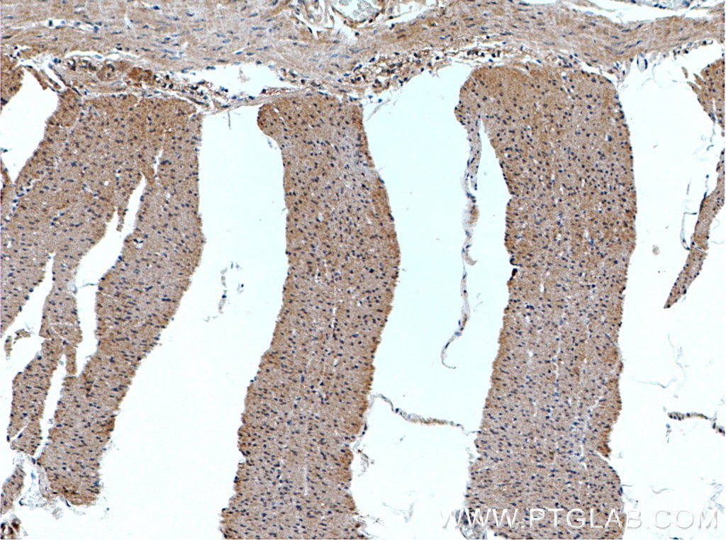 Immunohistochemistry (IHC) staining of human colon tissue using SPTLC2 Polyclonal antibody (51012-2-AP)