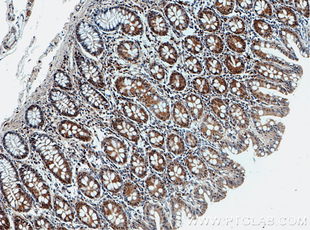 Immunohistochemistry (IHC) staining of human colon tissue using SPTLC2 Polyclonal antibody (51012-2-AP)