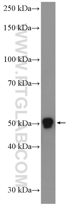 Western Blot (WB) analysis of mouse brain tissue using SPTLC2 Polyclonal antibody (51012-2-AP)