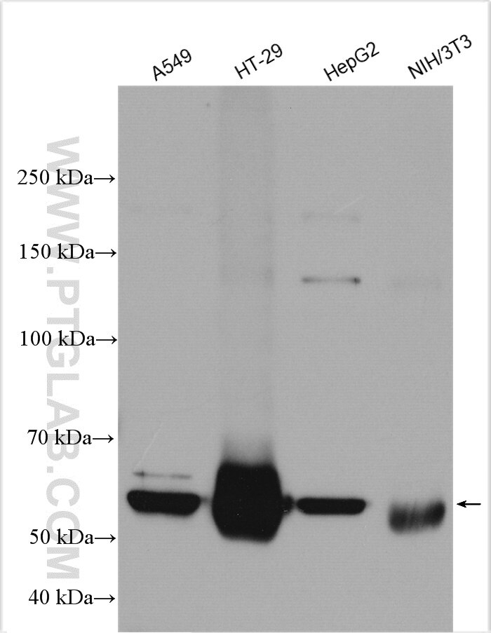 Western Blot (WB) analysis of various lysates using SPTLC2 Polyclonal antibody (51012-2-AP)