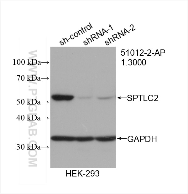 Western Blot (WB) analysis of HEK-293 cells using SPTLC2 Polyclonal antibody (51012-2-AP)