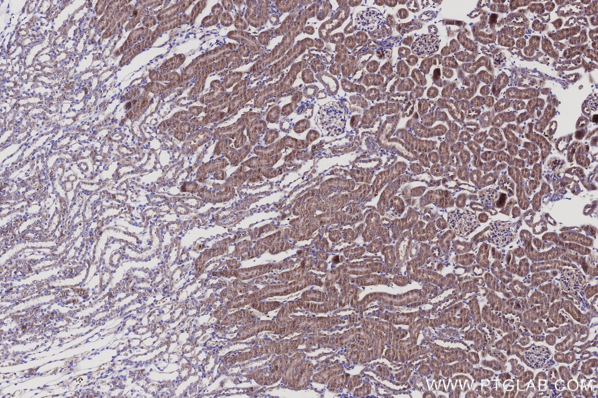 IHC staining of mouse kidney using 68094-1-Ig Immunohistochemistry (IHC) staining of mouse kidney tissue using SPTLC2 Monoclonal antibody (68094-1-Ig)