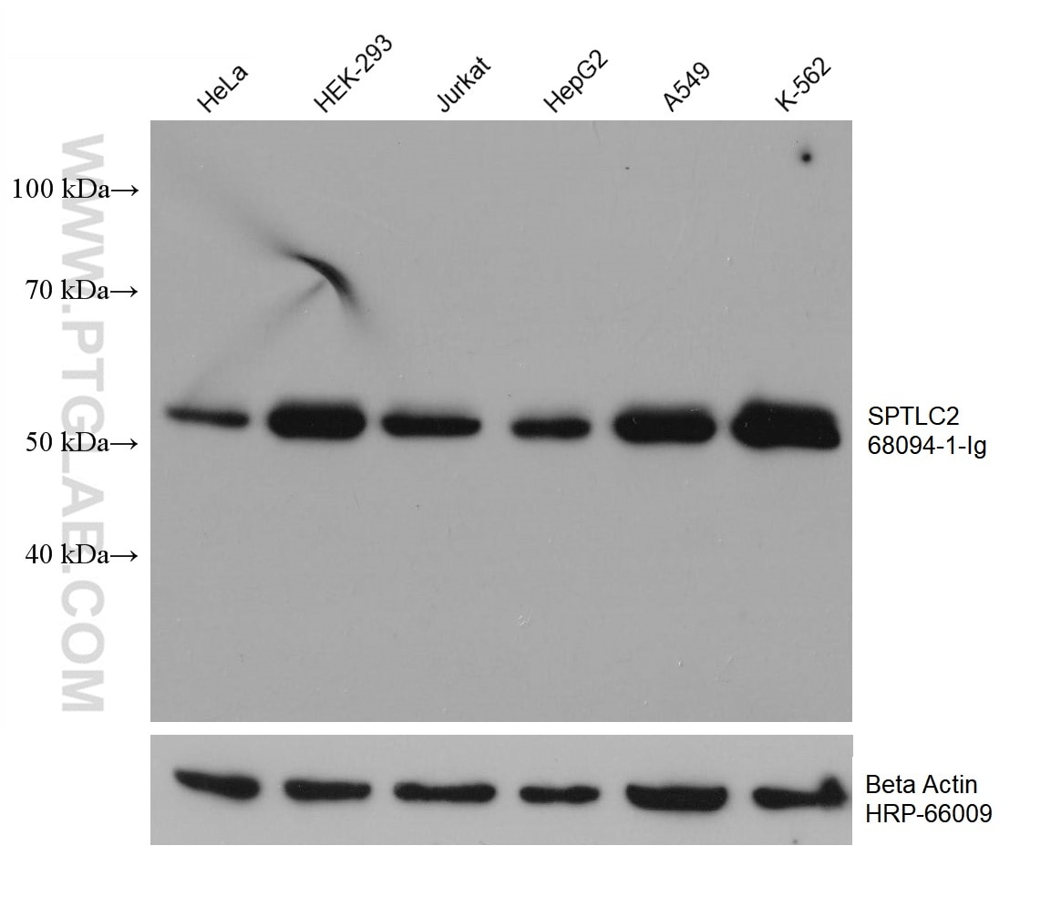 Western Blot (WB) analysis of various lysates using SPTLC2 Monoclonal antibody (68094-1-Ig)