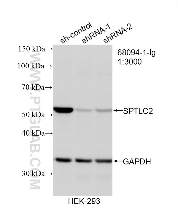 Western Blot (WB) analysis of HEK-293 cells using SPTLC2 Monoclonal antibody (68094-1-Ig)