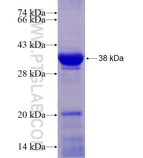SPTLC2 fusion protein Ag28380 SDS-PAGE