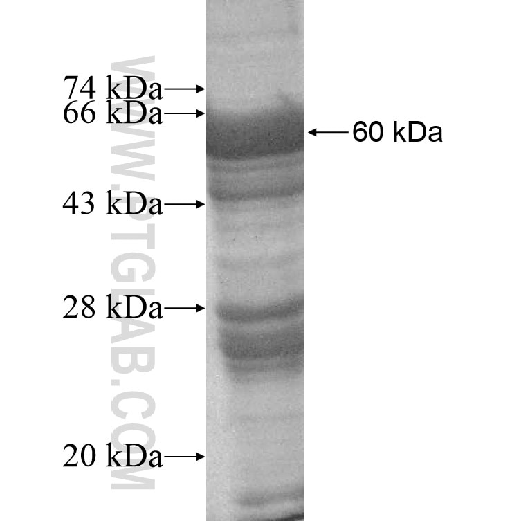 SPTLC2 fusion protein Ag7774 SDS-PAGE