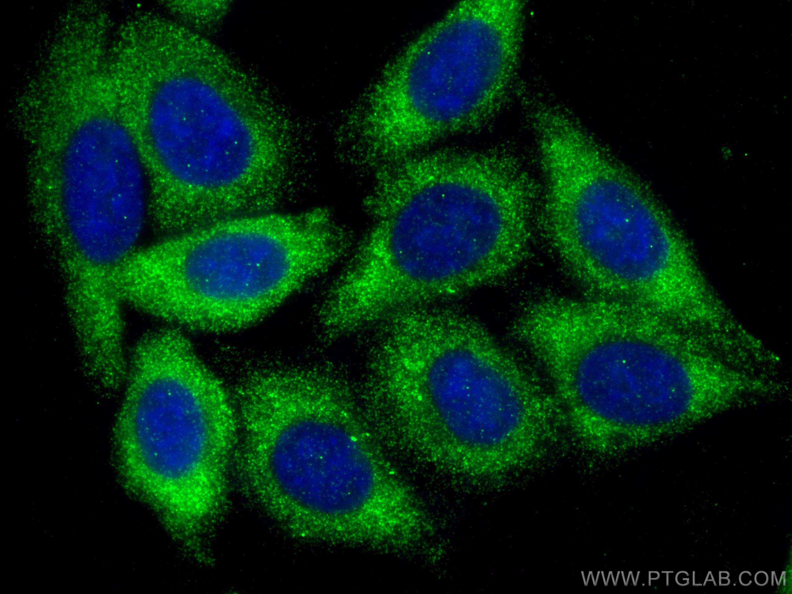 Immunofluorescence (IF) / fluorescent staining of HepG2 cells using SPTLC3 Polyclonal antibody (16600-1-AP)