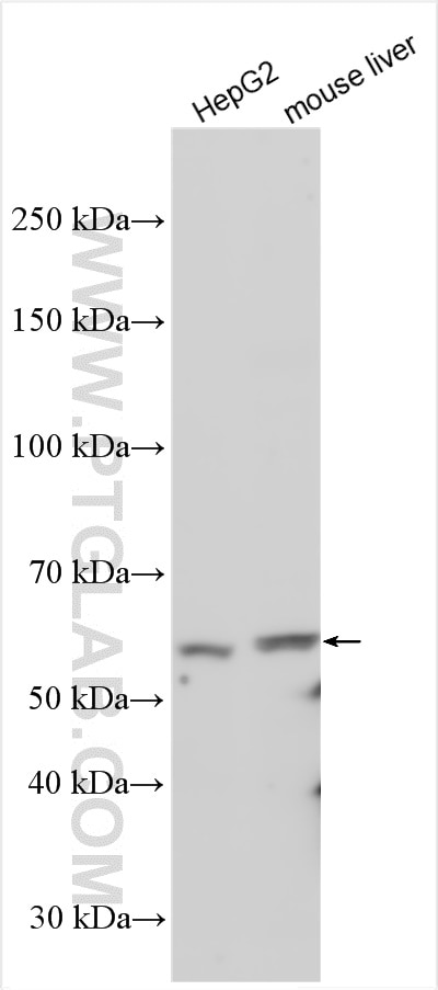 Western Blot (WB) analysis of various lysates using SPTLC3 Polyclonal antibody (16600-1-AP)