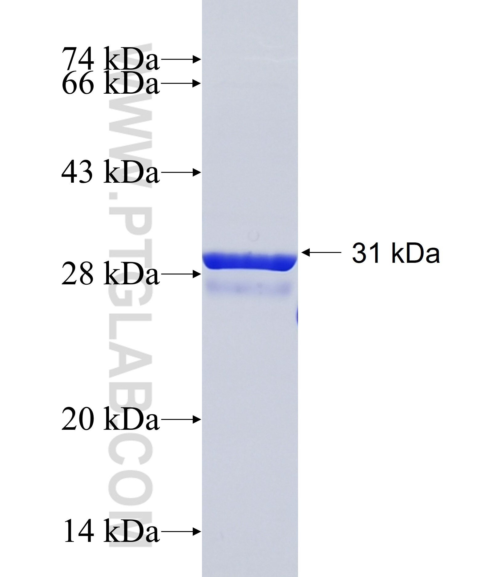 C14orf147 fusion protein Ag37105 SDS-PAGE C14orf147 fusion protein Ag37105 SDS-PAGE