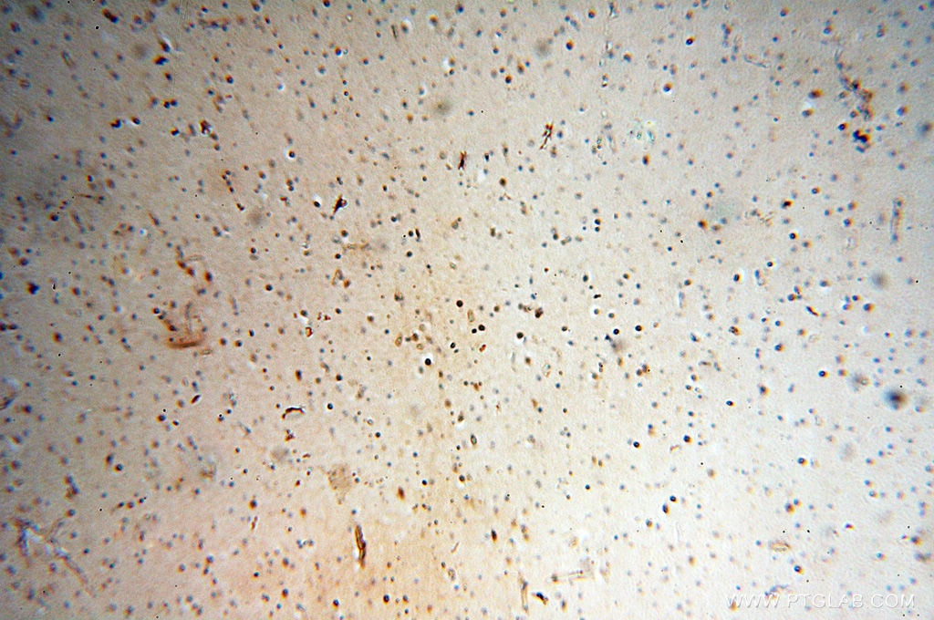 Immunohistochemistry (IHC) staining of human brain tissue using SPZ1 Polyclonal antibody (18931-1-AP)