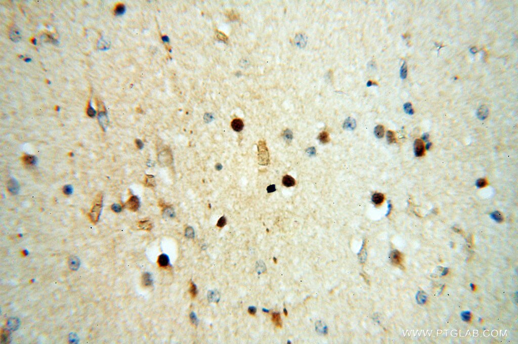 Immunohistochemistry (IHC) staining of human brain tissue using SPZ1 Polyclonal antibody (18931-1-AP)