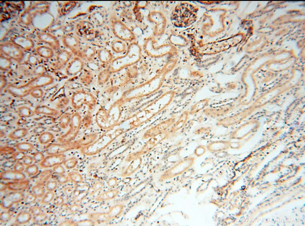 Immunohistochemistry (IHC) staining of human kidney tissue using SPZ1 Polyclonal antibody (18931-1-AP)