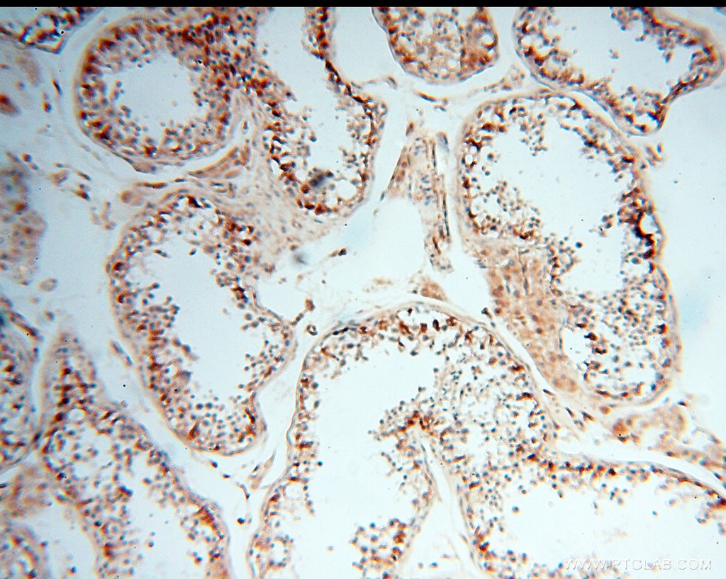 Immunohistochemistry (IHC) staining of human testis tissue using SPZ1 Polyclonal antibody (18931-1-AP)