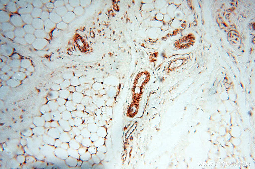 Immunohistochemistry (IHC) staining of human skin tissue using SPZ1 Polyclonal antibody (18931-1-AP)