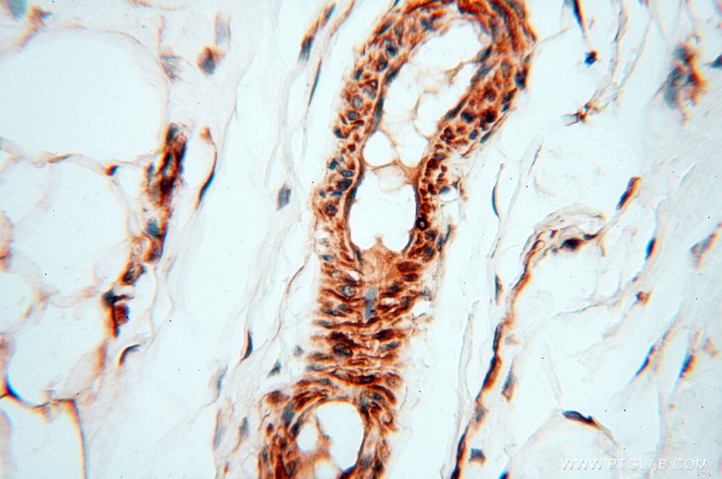 IHC staining of human skin using 18931-1-AP