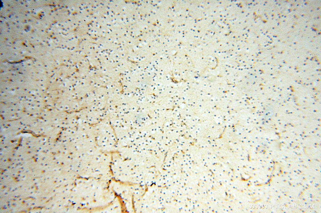 Immunohistochemistry (IHC) staining of human brain tissue using SPZ1 Polyclonal antibody (18931-1-AP)