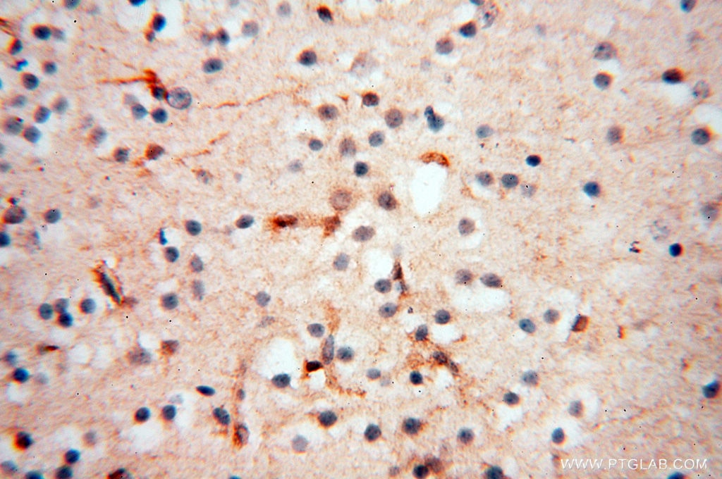 Immunohistochemistry (IHC) staining of human brain tissue using SPZ1 Polyclonal antibody (18931-1-AP)