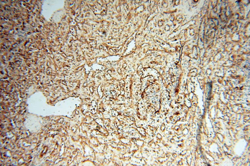 Immunohistochemistry (IHC) staining of human spleen tissue using SPZ1 Polyclonal antibody (18931-1-AP)