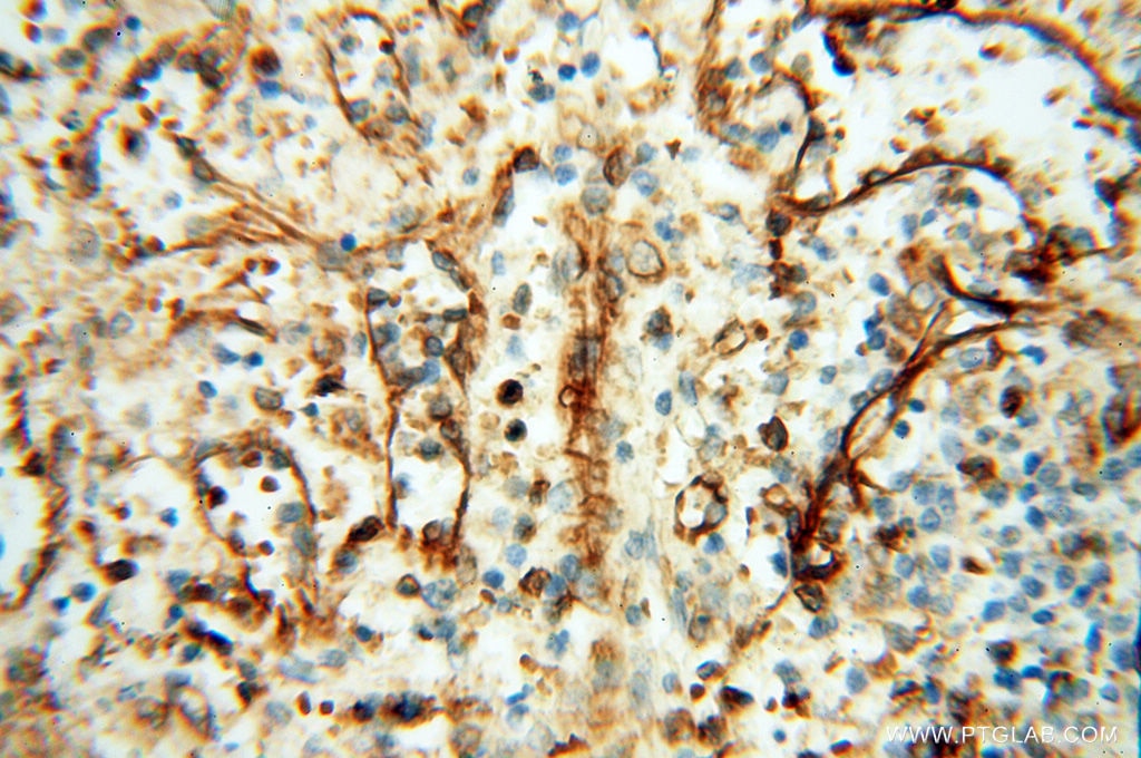 Immunohistochemistry (IHC) staining of human spleen tissue using SPZ1 Polyclonal antibody (18931-1-AP)