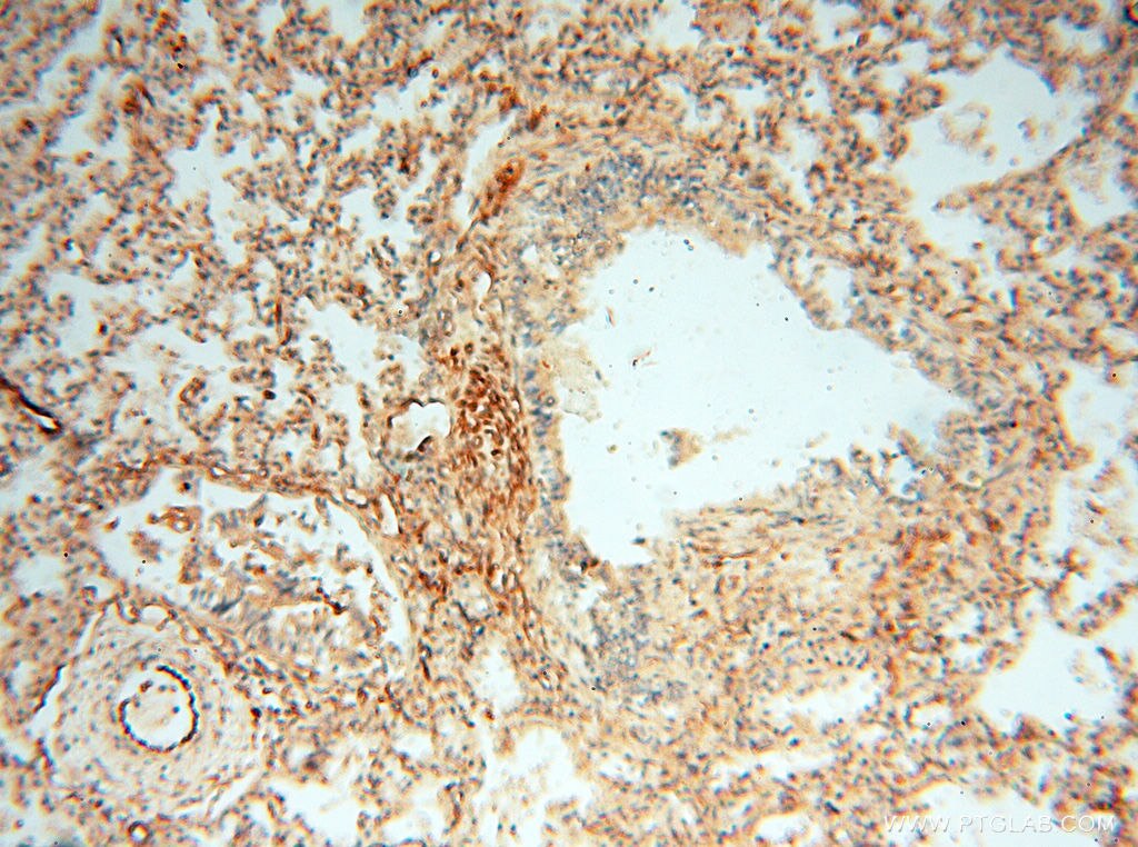 Immunohistochemistry (IHC) staining of human lung tissue using SPZ1 Polyclonal antibody (18931-1-AP)