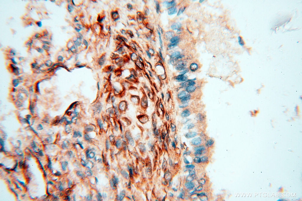 Immunohistochemistry (IHC) staining of human lung tissue using SPZ1 Polyclonal antibody (18931-1-AP)