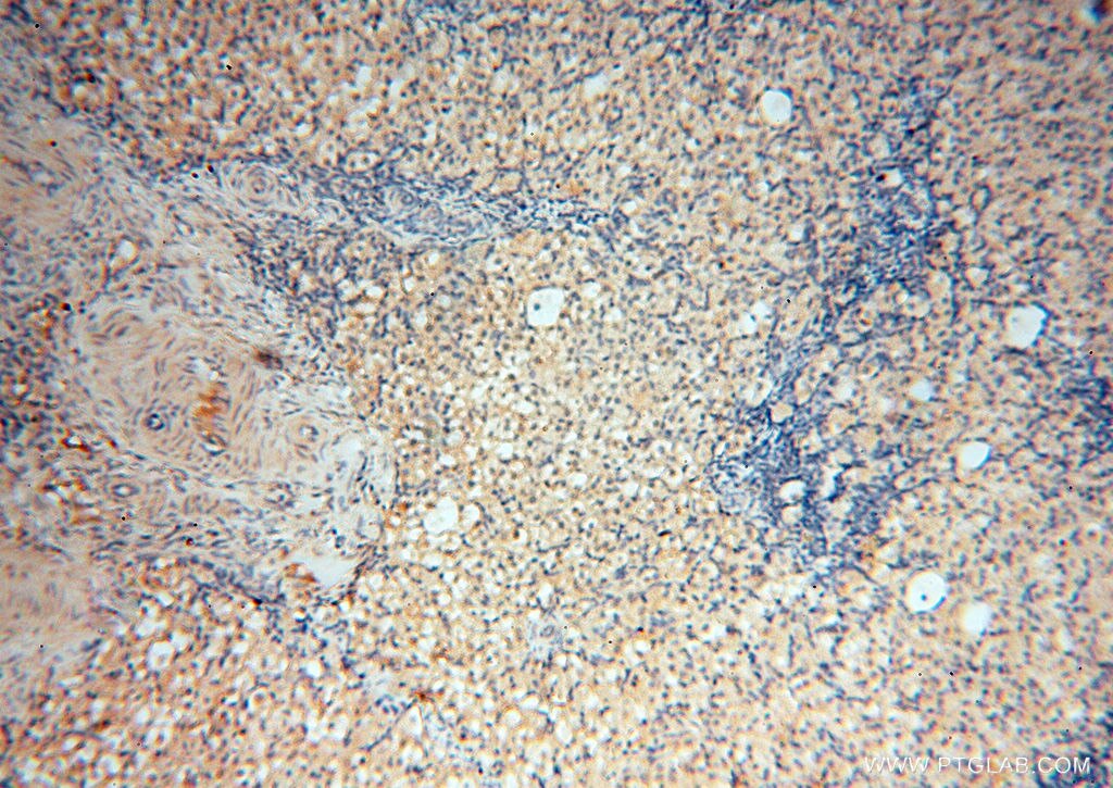 Immunohistochemistry (IHC) staining of human ovary tissue using SPZ1 Polyclonal antibody (18931-1-AP)
