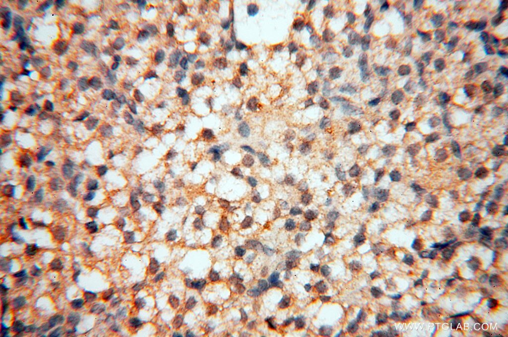 Immunohistochemistry (IHC) staining of human ovary tissue using SPZ1 Polyclonal antibody (18931-1-AP)