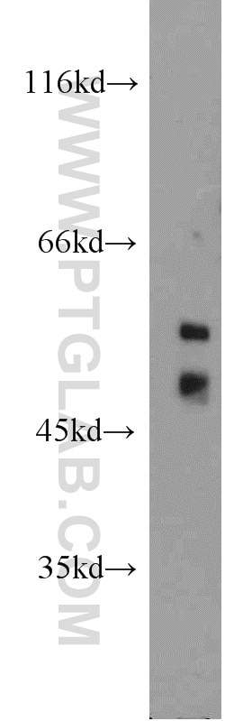 Western Blot (WB) analysis of human testis tissue using SPZ1 Polyclonal antibody (18931-1-AP)