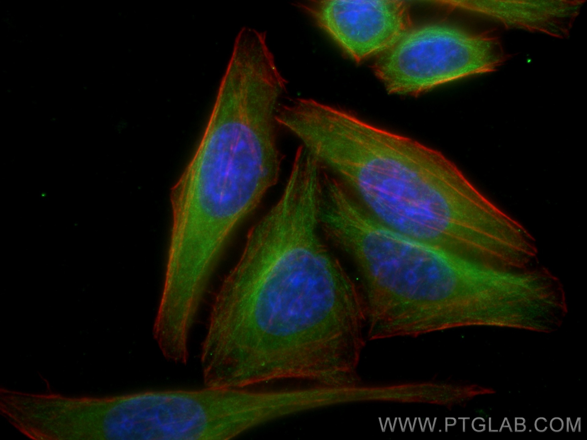 Immunofluorescence (IF) / fluorescent staining of HepG2 cells using SQLE Polyclonal antibody (12544-1-AP)