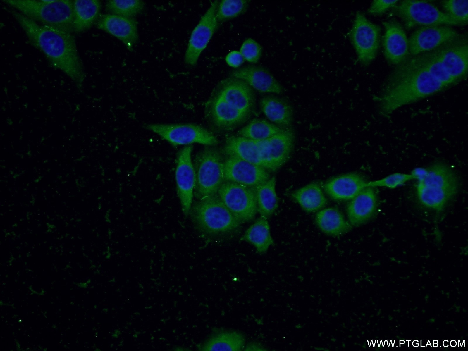 Immunofluorescence (IF) / fluorescent staining of PC-3 cells using SQLE Polyclonal antibody (12544-1-AP)