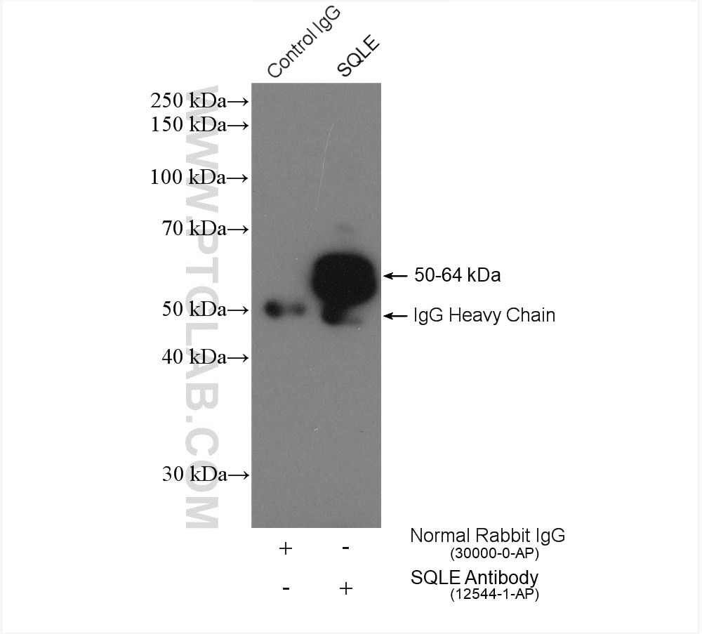 Immunoprecipitation (IP) experiment of HepG2 cells using SQLE Polyclonal antibody (12544-1-AP)