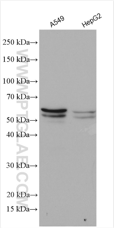 Western Blot (WB) analysis of various lysates using SQLE Polyclonal antibody (12544-1-AP)