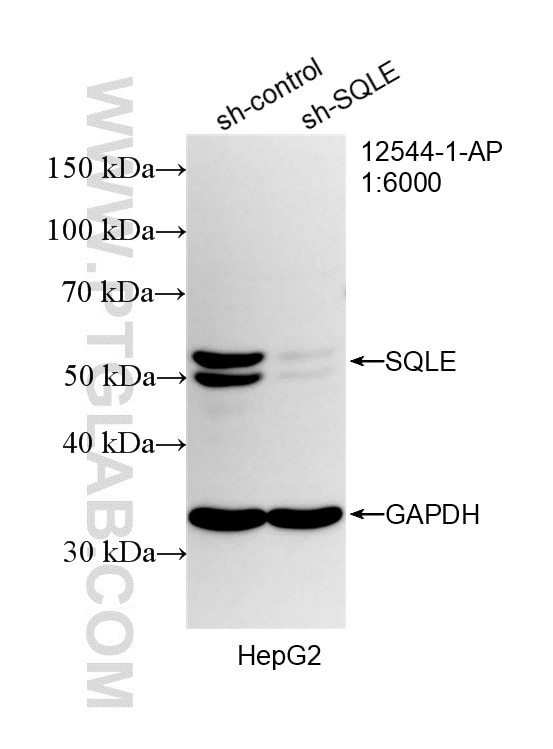 Western Blot (WB) analysis of HepG2 cells using SQLE Polyclonal antibody (12544-1-AP)