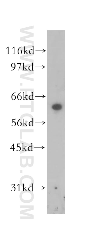 SQLE Polyclonal antibody