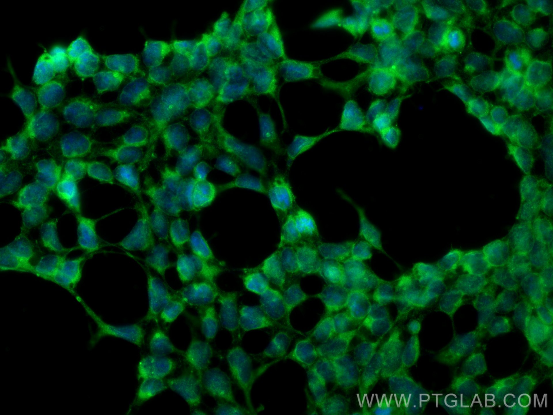 Immunofluorescence (IF) / fluorescent staining of HEK-293 cells using SQLE Monoclonal antibody (67206-1-Ig)