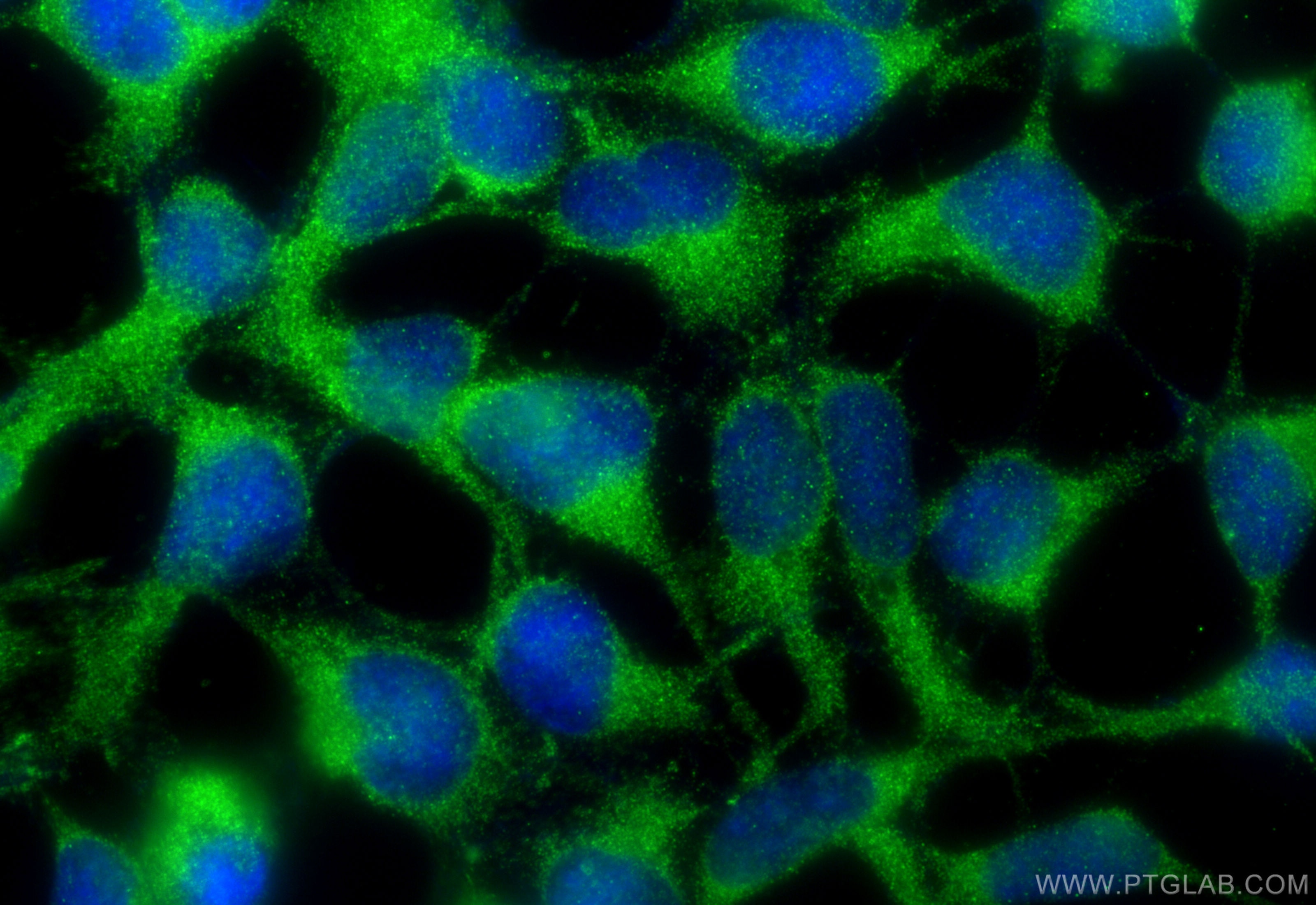 Immunofluorescence (IF) / fluorescent staining of HEK-293 cells using SQLE Monoclonal antibody (67206-1-Ig)