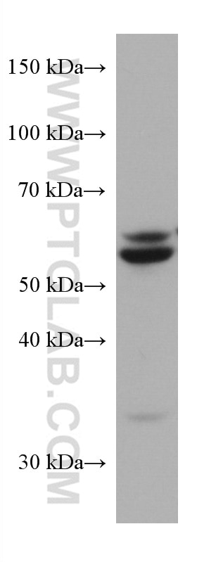Western Blot (WB) analysis of L02 cells using SQLE Monoclonal antibody (67206-1-Ig)
