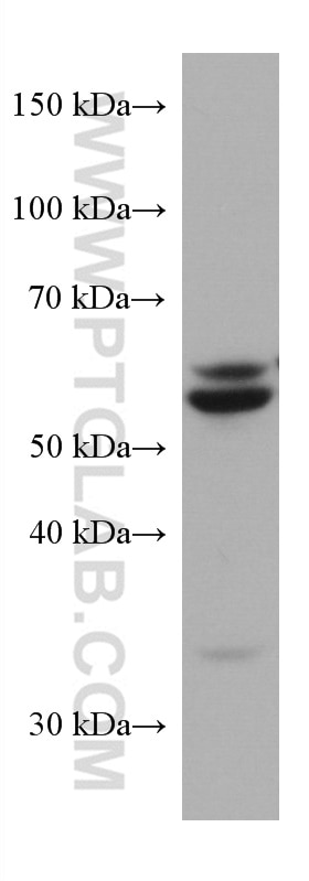 WB analysis of L02 using 67206-1-Ig