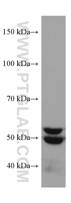 Western Blot (WB) analysis of HEK-293 cells using SQLE Monoclonal antibody (67206-1-Ig)