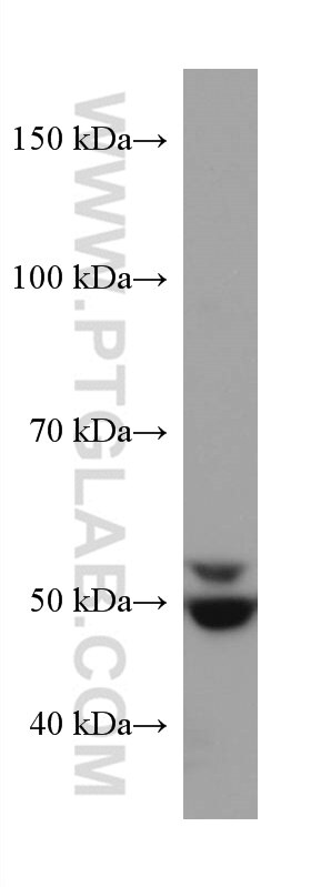 Western Blot (WB) analysis of HepG2 cells using SQLE Monoclonal antibody (67206-1-Ig)