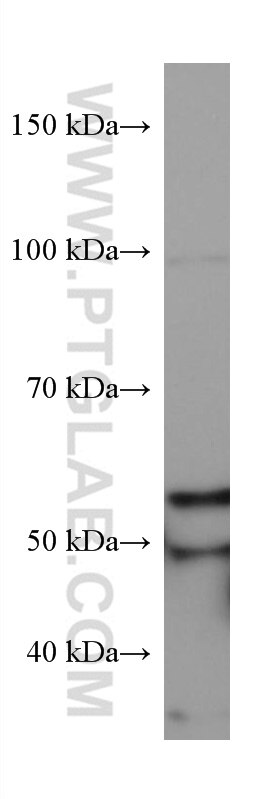 Western Blot (WB) analysis of HSC-T6 cells using SQLE Monoclonal antibody (67206-1-Ig)