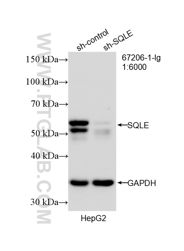 Western Blot (WB) analysis of HepG2 cells using SQLE Monoclonal antibody (67206-1-Ig)